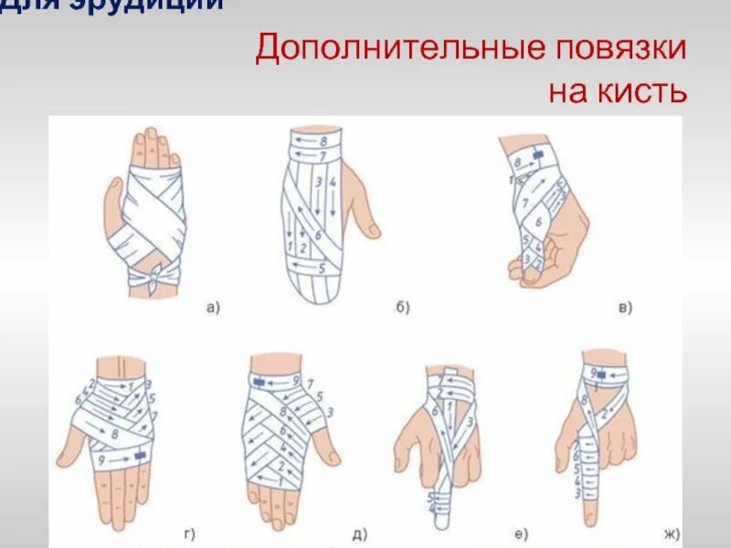 Алгоритм повязки. Циркуляторная повязка десмургия. повязка на запястье десмургия. десмургия верхних конечностей. повязки на голову десмургия.