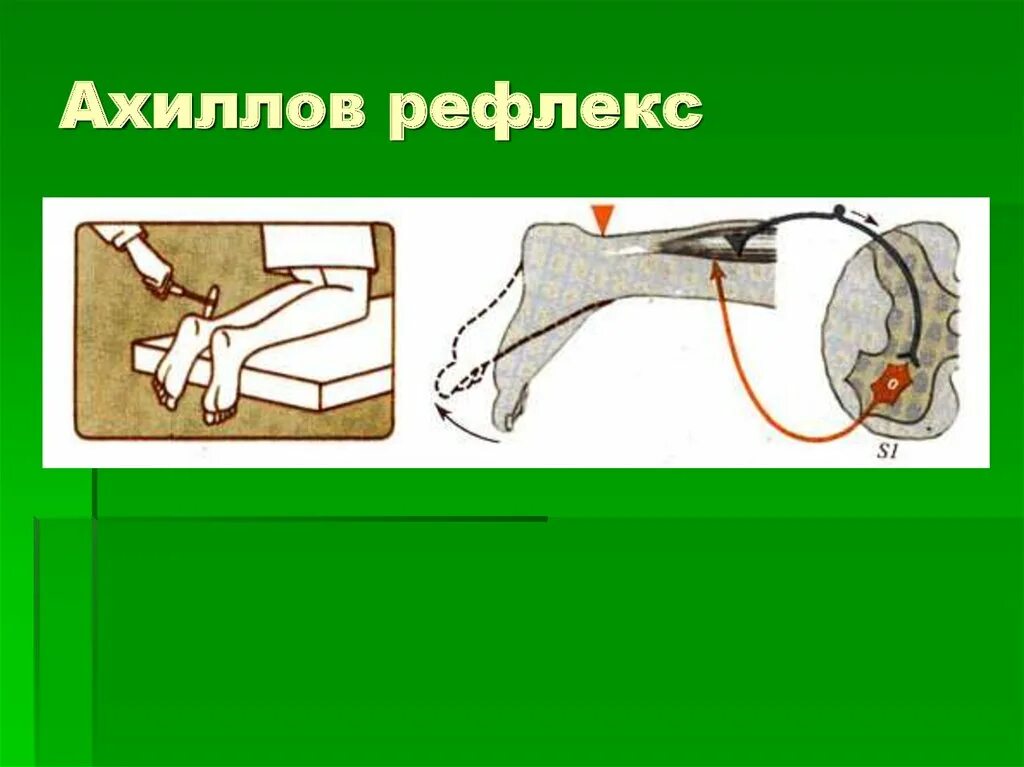 Ахиллов рефлекс рефлекторная дуга. Рефлекторная дуга ахиллова рефлекса. Схема рефлекторной дуги ахиллова рефлекса. Схема дуги ахиллова рефлекса.