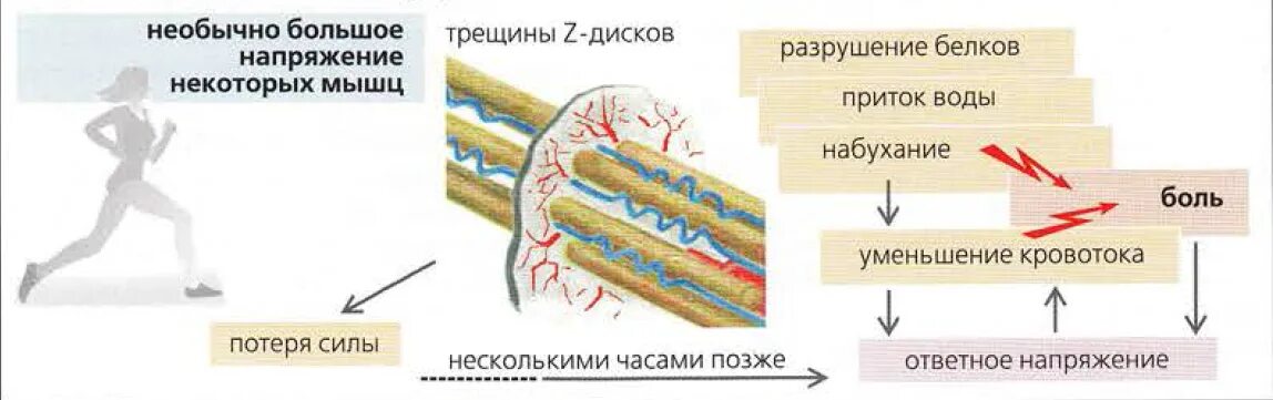 Боль после сильных нагрузок