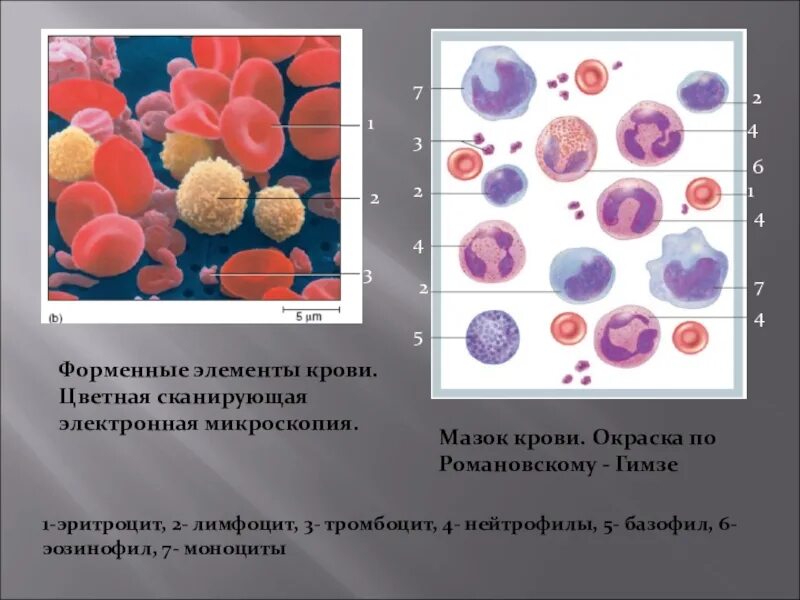 Форменные элементы формы. Мазок периферической крови с микроскопией. Мазок крови: эритроциты, лимфоциты, нейтрофилы, тромбоциты, моноциты.. Форменные элементы крови под микроскопом гистология. Лимфоциты в крови гистология.