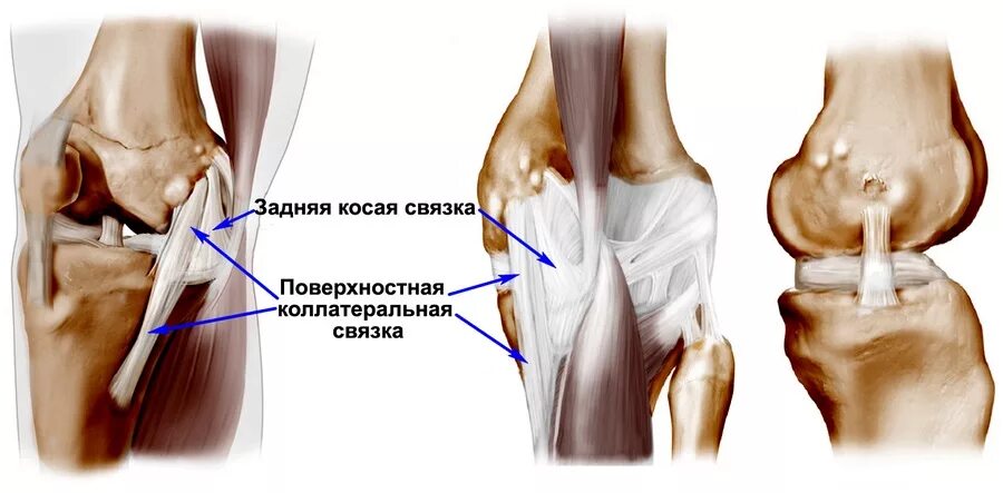 Травма связок сустава. Разрыв коллатеральной связки коленного сустава. Перерастяжение связок коленного сустава. Внесуставные связки коленного сустава. Разрыв большеберцовой коллатеральной связки коленного сустава.