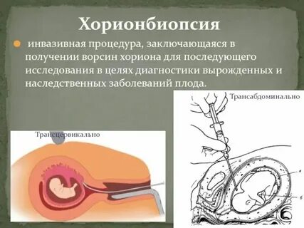Инвазивные лечебно диагностические процедуры