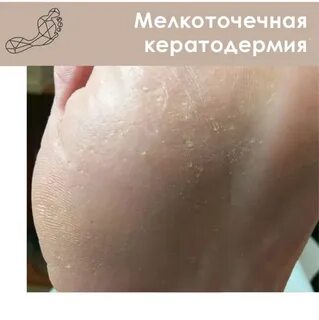 Мелкоточечное изображение 5