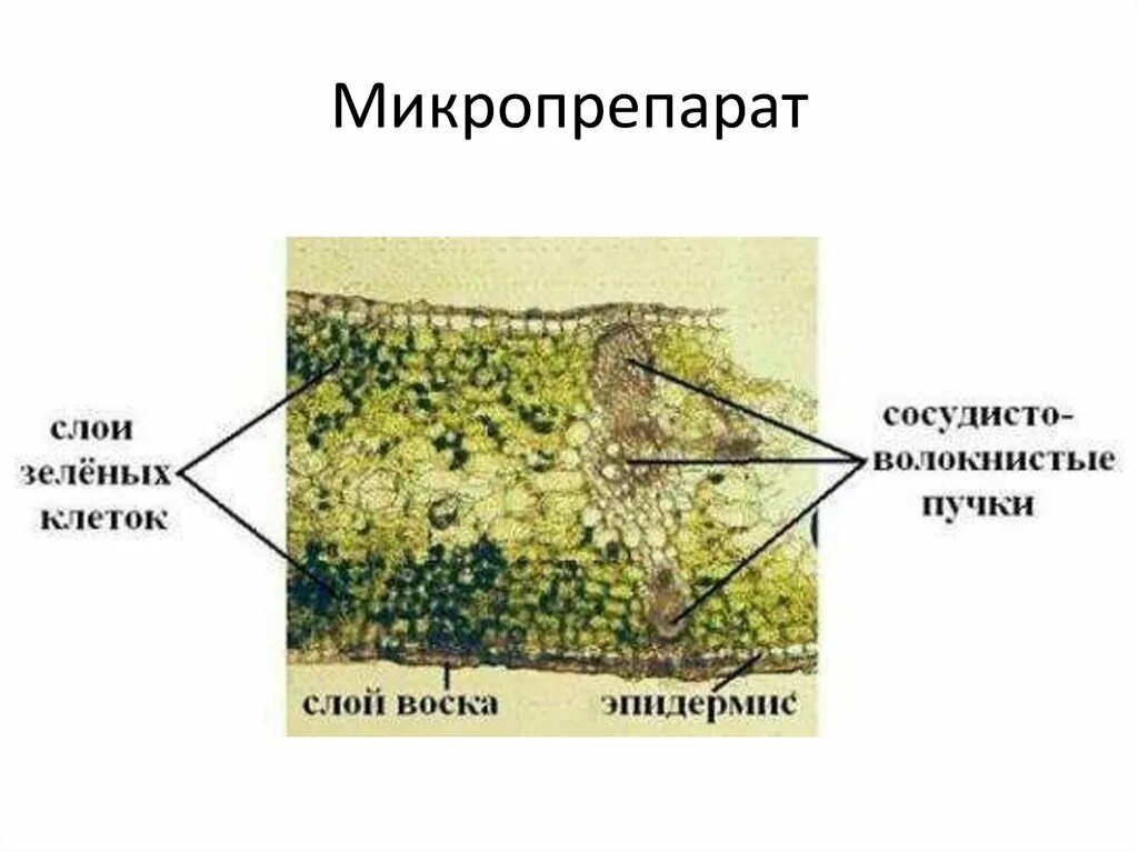 Выберите структуры которые отсутствуют из представленного микропрепарат. Микропрепарат листа. микропрепарат временные. хитиновый слой. постоянный микропрепарат.