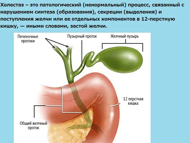 Желчный пузырь застой отзывы