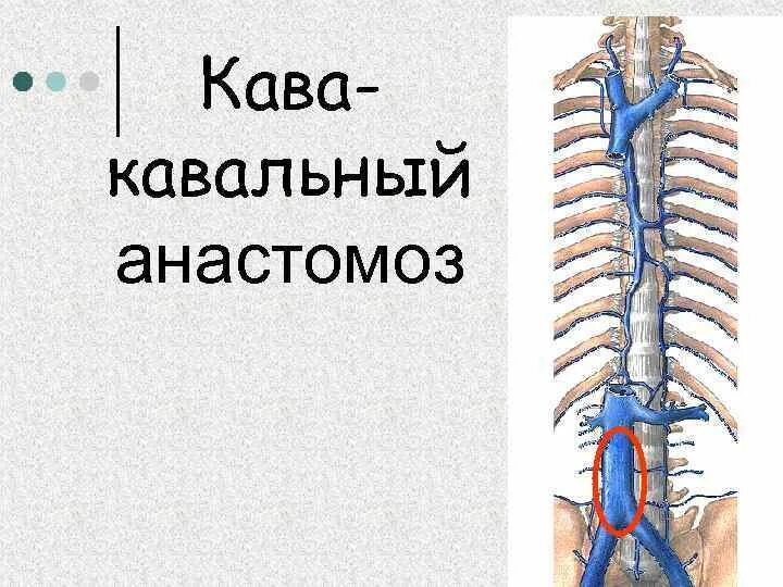Значение кава кавальных анастомозов. Полунепарная вена анатомия. екпарная полунепарная вена. кавакавальные анастомозы. кава кавальные анастомозы анатомия.