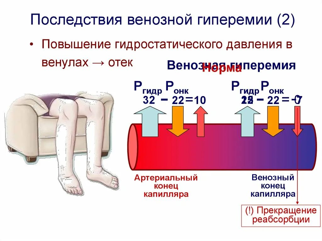 Последствия венозной гиперемии. Венозное полнокровие увеличение гидростатического давления. Осложнения артериальной гиперемии.