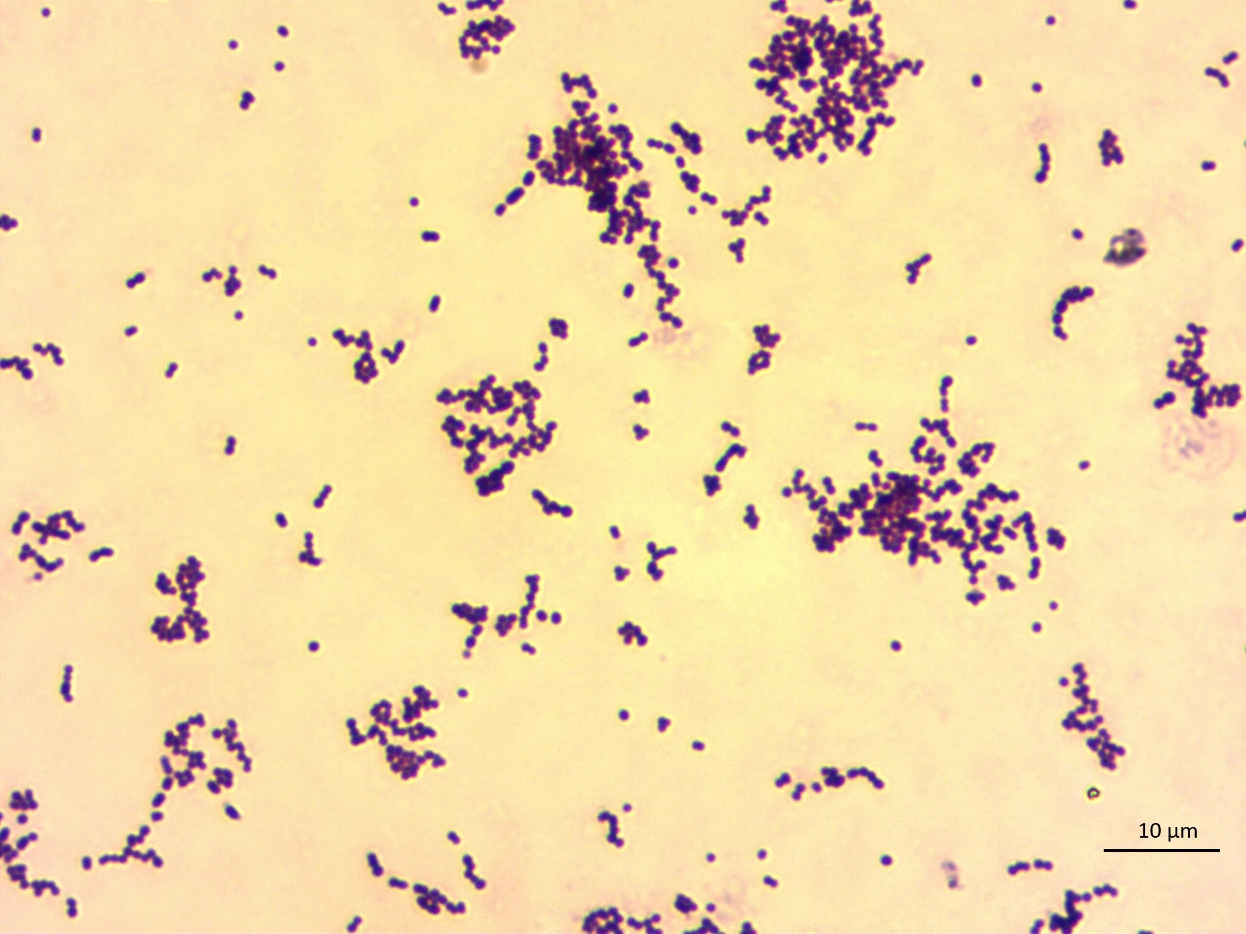 Streptococcus в мазке у мужчин. Стрептококк микроскопия. Палочки Дедерлейна микроскопия. Enterococcus faecalis по Граму. Энтерококки микроскопия.