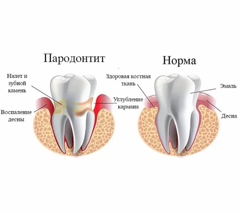 Признаки стороны зуба. Заболевания зубов и десен.