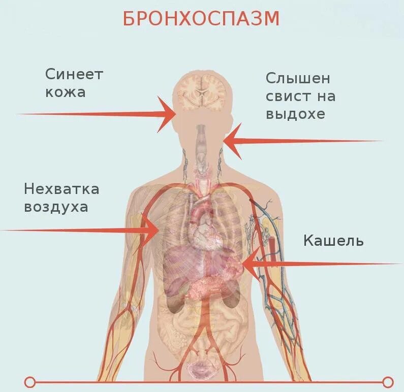 Выдох со свистом у взрослого. Бронхоспазм проявления.