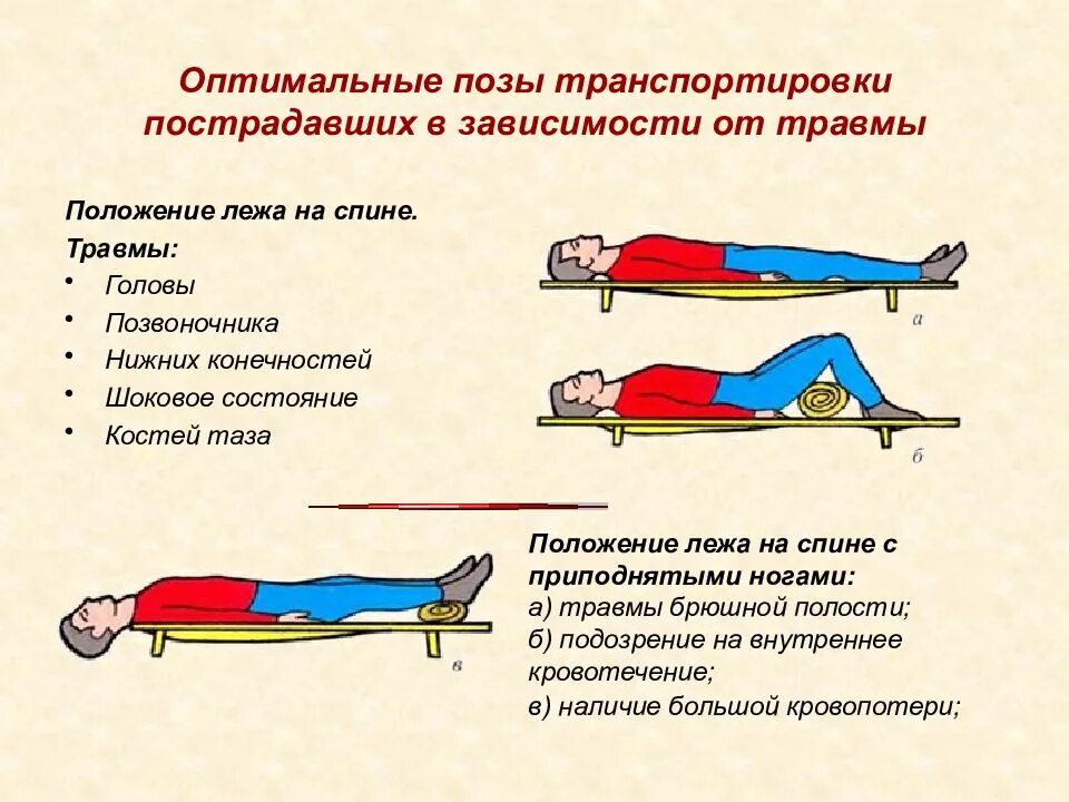 В зависимости от того какой лежит. Транспортировка пострадавшего при травме верхних конечностей. Оптимальное положение пострадавшего при переломе позвоночника. Транспортировка пострадавшего с травмами позвоночника таза. Вид транспортировки пострадавшего при травме бедра.