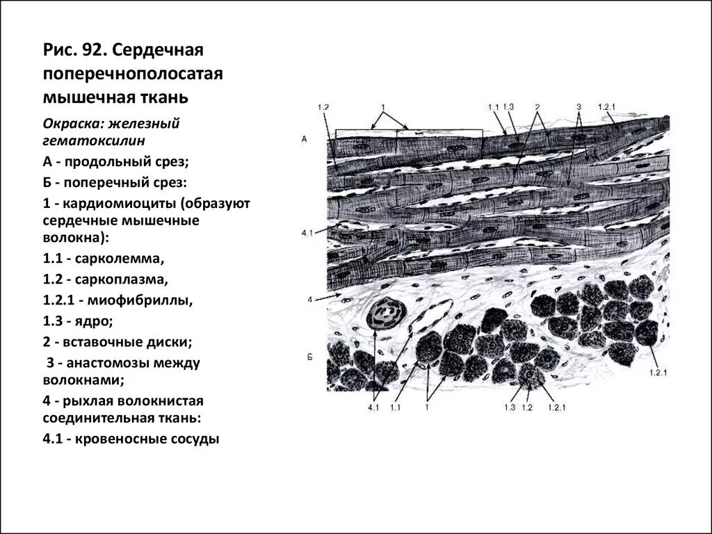 Сердечная мышечная ткань рисунок. Строение поперечно полосатой скелетной мышечной ткани гистология. Сердечная мышечная ткань гистология Железный гематоксилин. Поперечно-полосатая сердечная мышечная ткань препарат. Сердечная мышечная ткань окраска Железный гематоксилин.