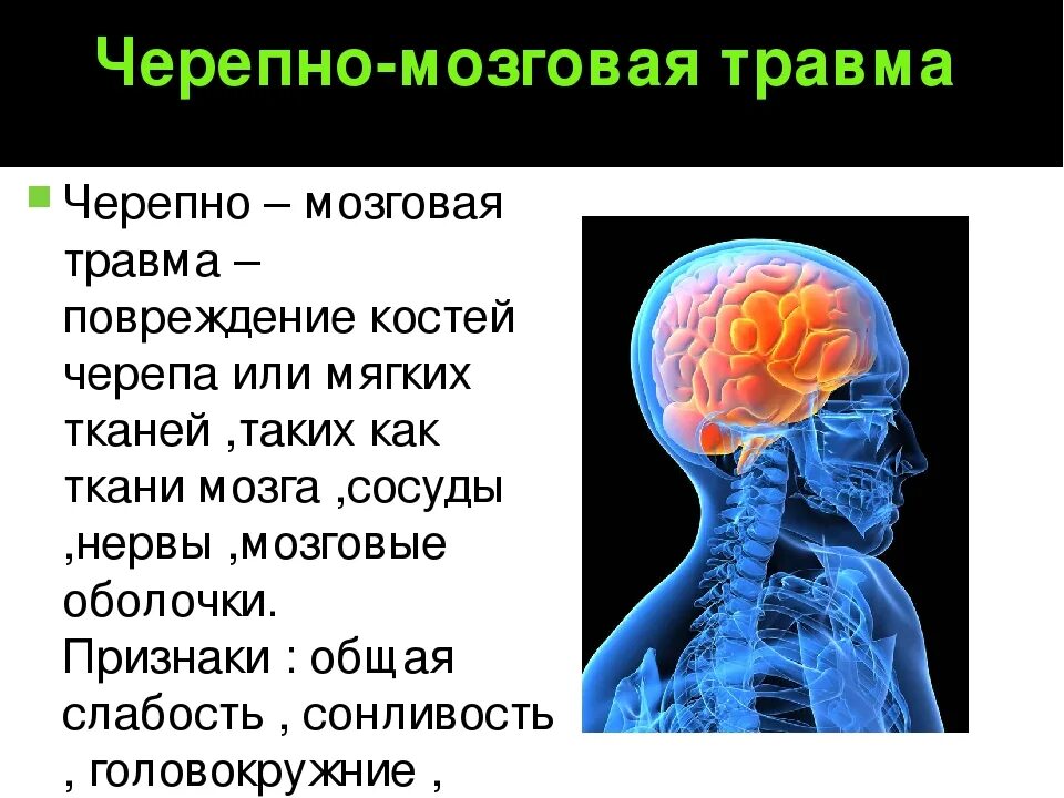 Черепно мозговые Травиа. Черепноиозгорвая травма. Черебномозговая травма. Травмы черепа и головного мозга