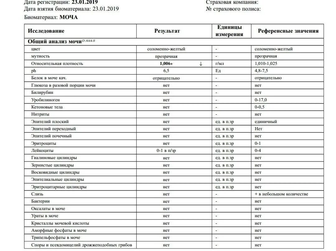 Фосфаты в моче у мужчин. Кристаллы оксалата кальция в моче норма у мужчин. Анализ мочи норма соли оксалаты в моче. Кристаллы оксалата кальция в моче у женщины норма. Общий анализ мочи оксалаты норма.