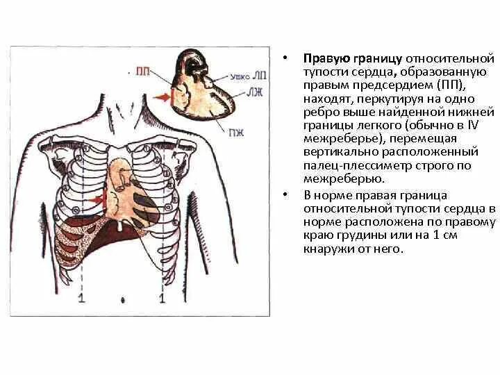 Относительная тупость. Относительная тупость сердца перкуссия норма. границы относительной тупости сердца перкуссия. перкуссия границ относительной тупости сердца норма. методика перкуссии границ относительной тупости сердца у детей.