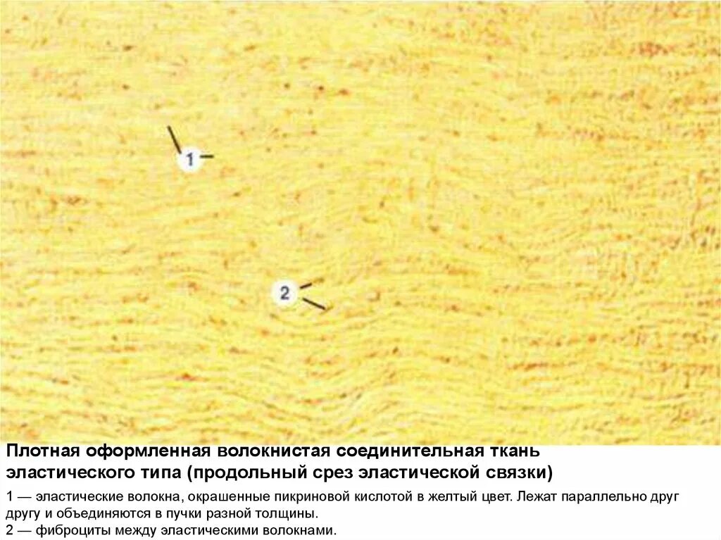 Эластическая связка. Эластическая соединительная ткань выйная связка. плотная волокнистая соединительная ткань эластического типа. плотная оформленная соединительная ткань выйная связка. плотная оформленная волокнистая соединительная ткань связка.