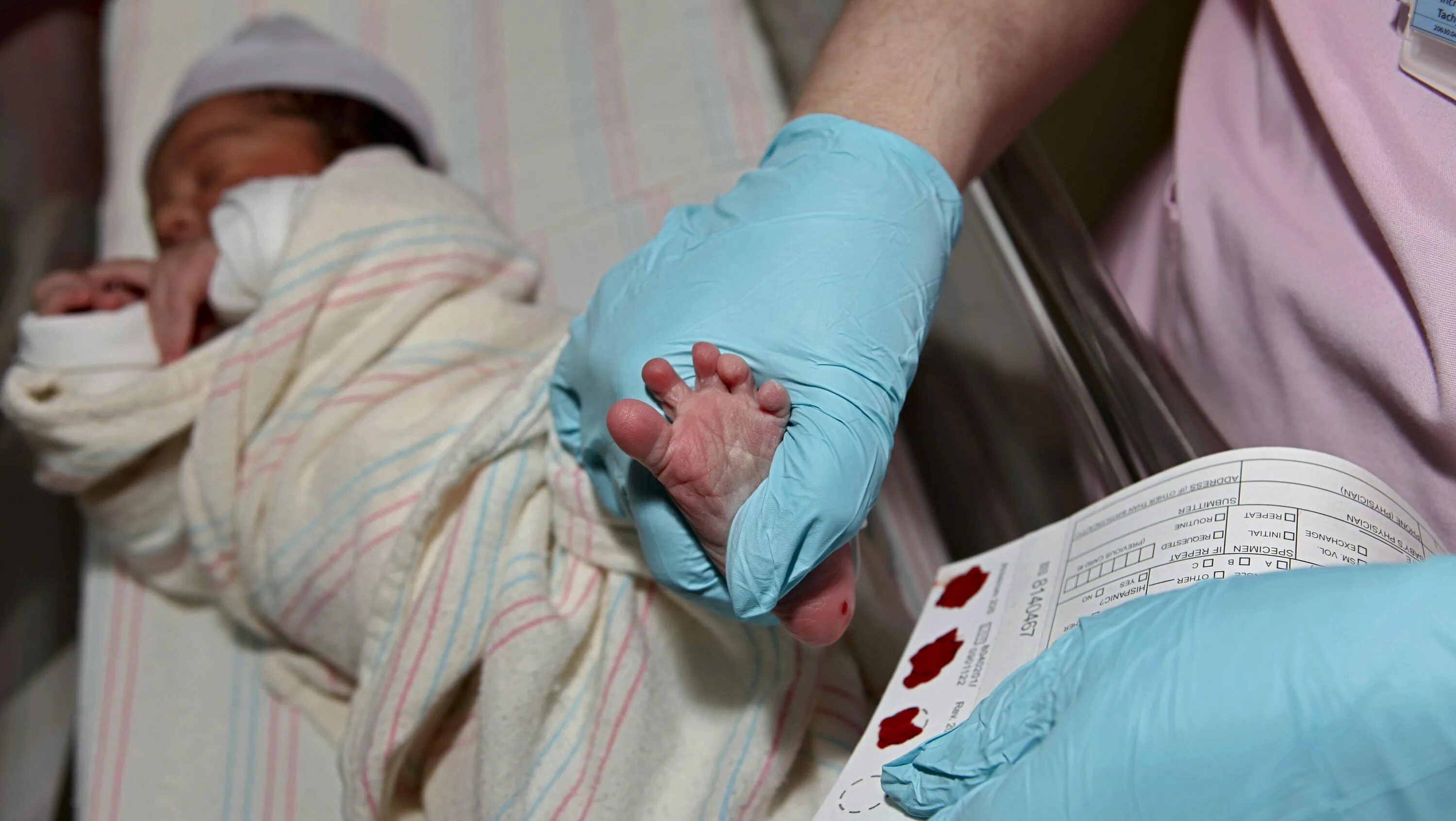 Почему новорожденный не берет. Забор крови на неонатальный скрининг. Забор крови из пятки новорожденного. Неонатальный скрининг новорожденных. Забор крови у новорожденного на неонатальный скрининг.