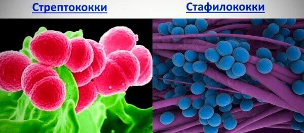 Staphylococcus viridans
