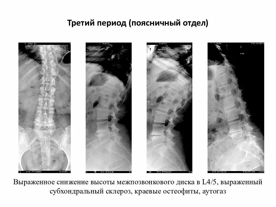 Высота дисков снижена