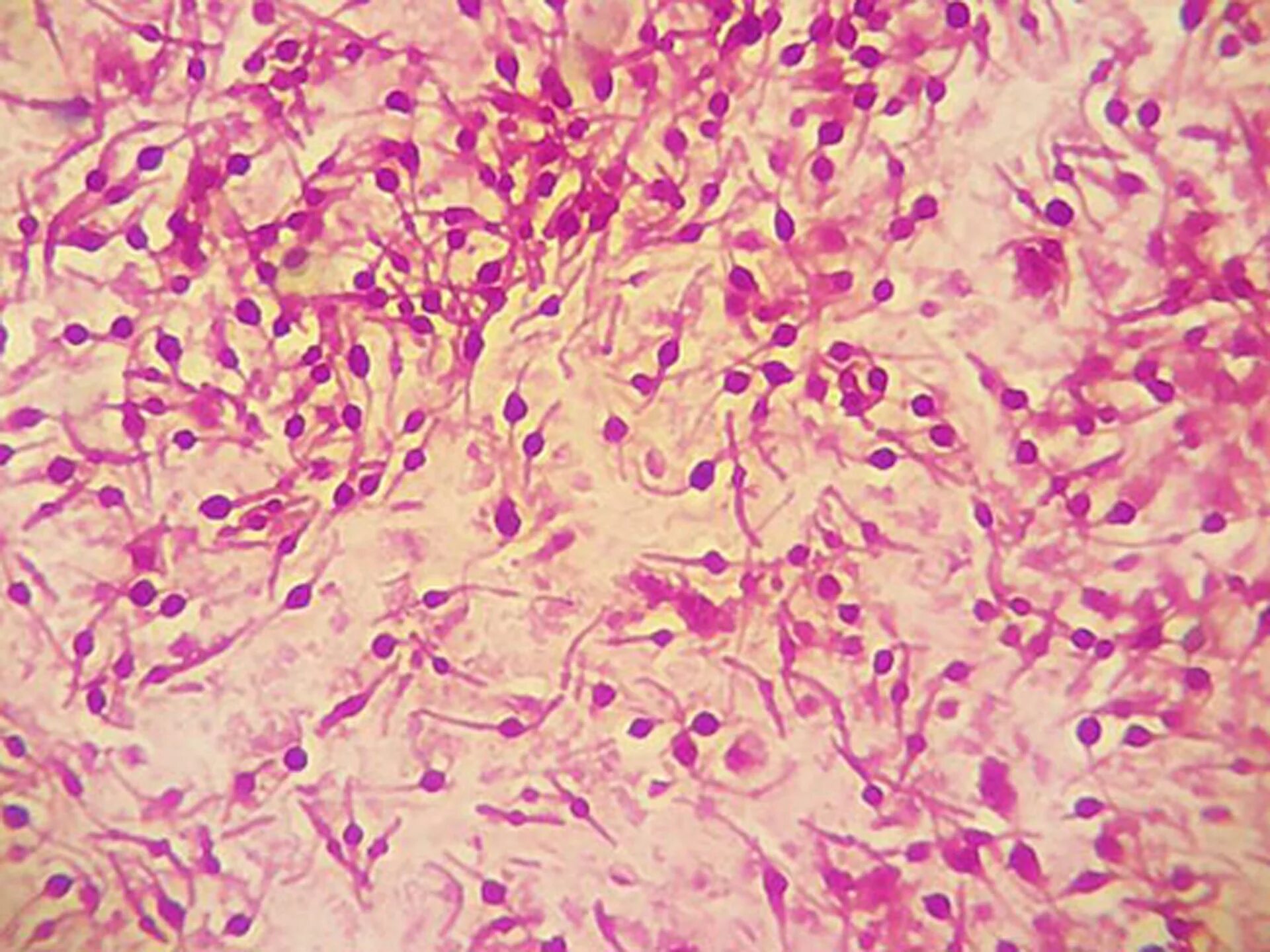 Fusobacterium spp
