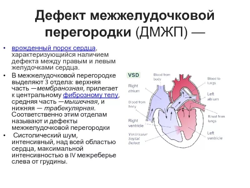 Врожденные пороки сердца дефект межпредсердной перегородки. Мембранозная часть межжелудочковой перегородки сердца. дефект межжелудочковой перегородки аускультация. инфундибулярный дефект межжелудочковой перегородки. дефект мембранозной части межжелудочковой перегородки.