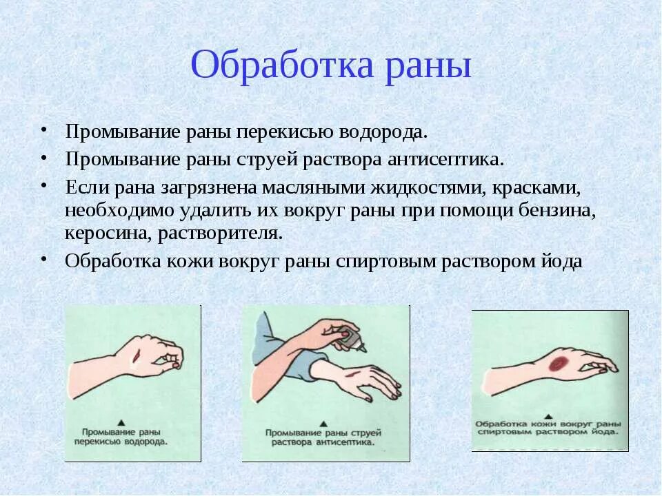 оказание первой доврачебной помощи пострадавшему. контролировать состояние пострадавшего. т и и оказание. что применяют для обработки кожи вокруг раны при оказании 1 помощи. т и и оказание.