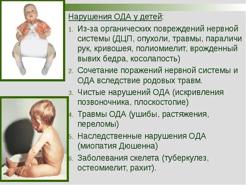 Церебральный паралич дцп. Парез гортани классификация. Перинатальное поражение центральной нервной системы. Органические параличи. Нейросифилис деменция.