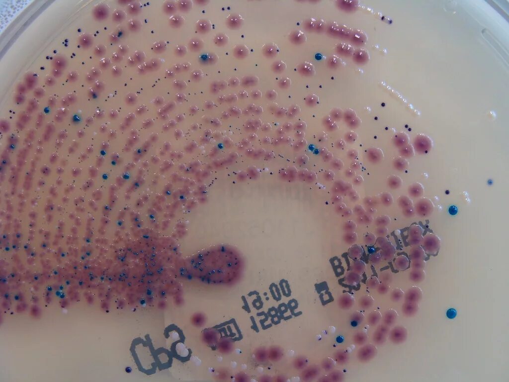 Бактерии в моче после лечения. Микроорганизмы в мочевом пузыре. Бактерии в моче под микроскопом. Бактерии в мочевом пузып.