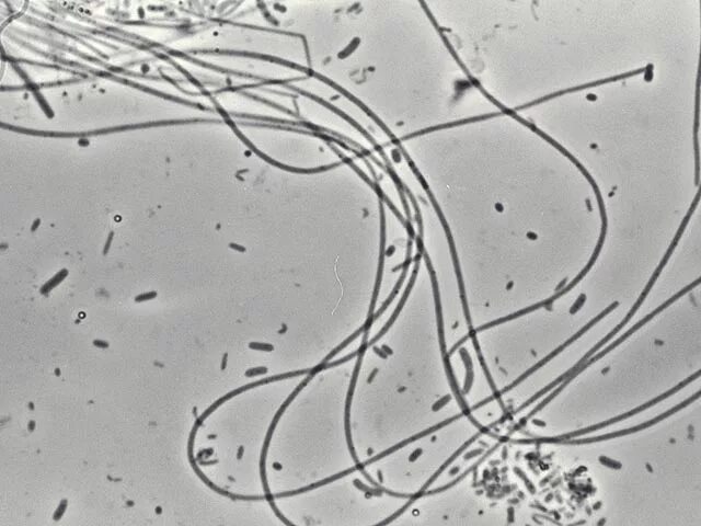 Лептотрикс лечение. Лептотрикс микроскопия. Нитчатые бактерии. Нитчатые бактерии (Sphaerotilus. Нитчатые микроорганизмы (Sphaerotilus, Leptothrix).