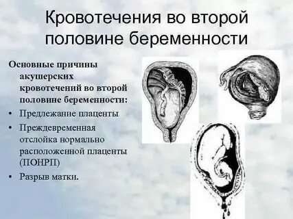 Кровит неделю после месячных