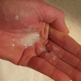 Yigitlar qollarini ishlatmasdan prostata bezlarini kesib otishadi.