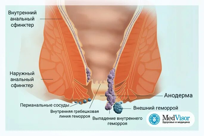 Проверка через задний проход