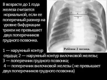 Рентген железа