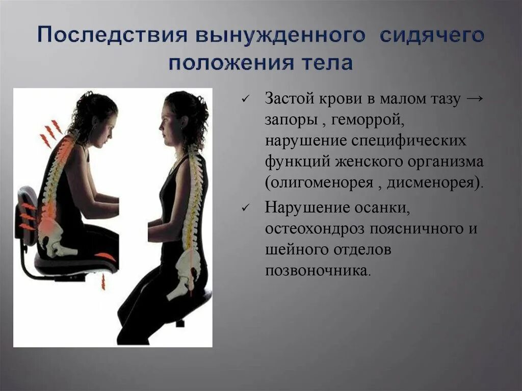 Нарушение осанки гиподинамия