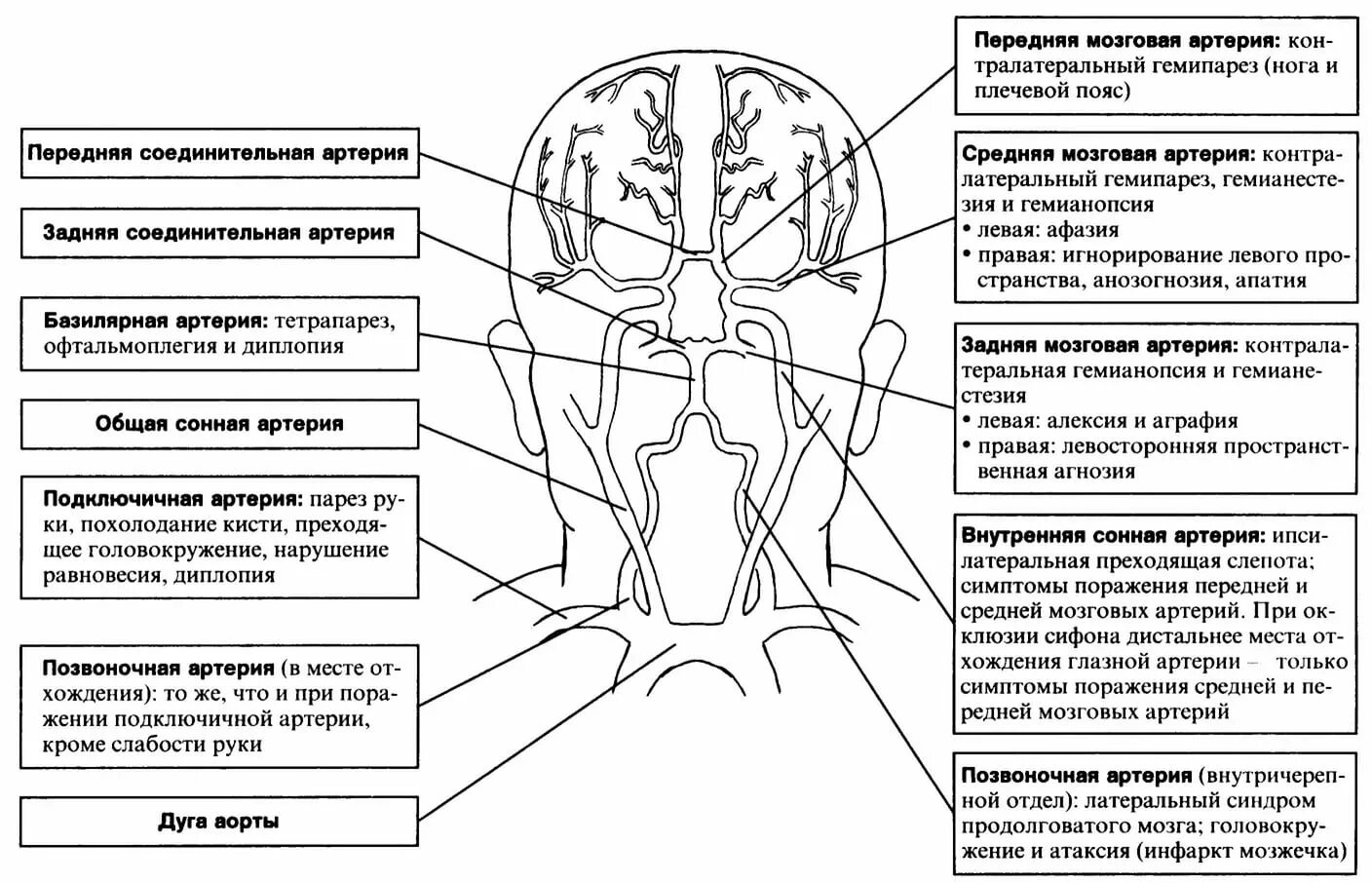 Ишемический инсульт синдромы неврология. Поражение в бассейне средней мозговой артерии. Бассейн средней мозговой артерии инсульт схема. Клиническая картина инсульта в бассейне средней мозговой артерии.