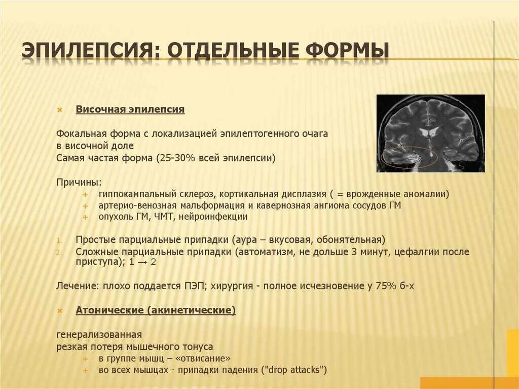 Виды припадков. Эпилепсия симптоматическая фокальная форма. Височная эпилепсия. Формы проявления эпилепсии. Приступы височной эпилепсии.