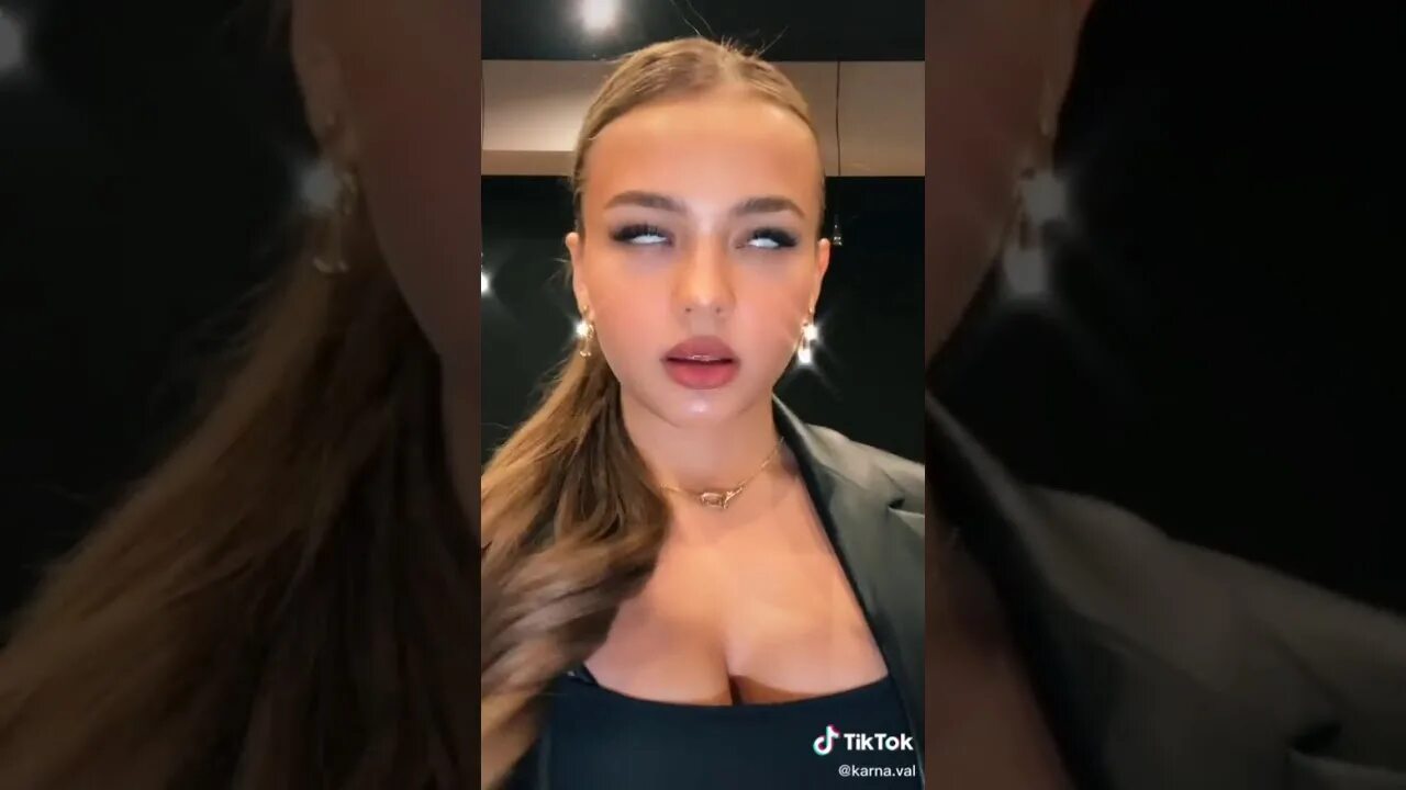 Карнавал делала операцию