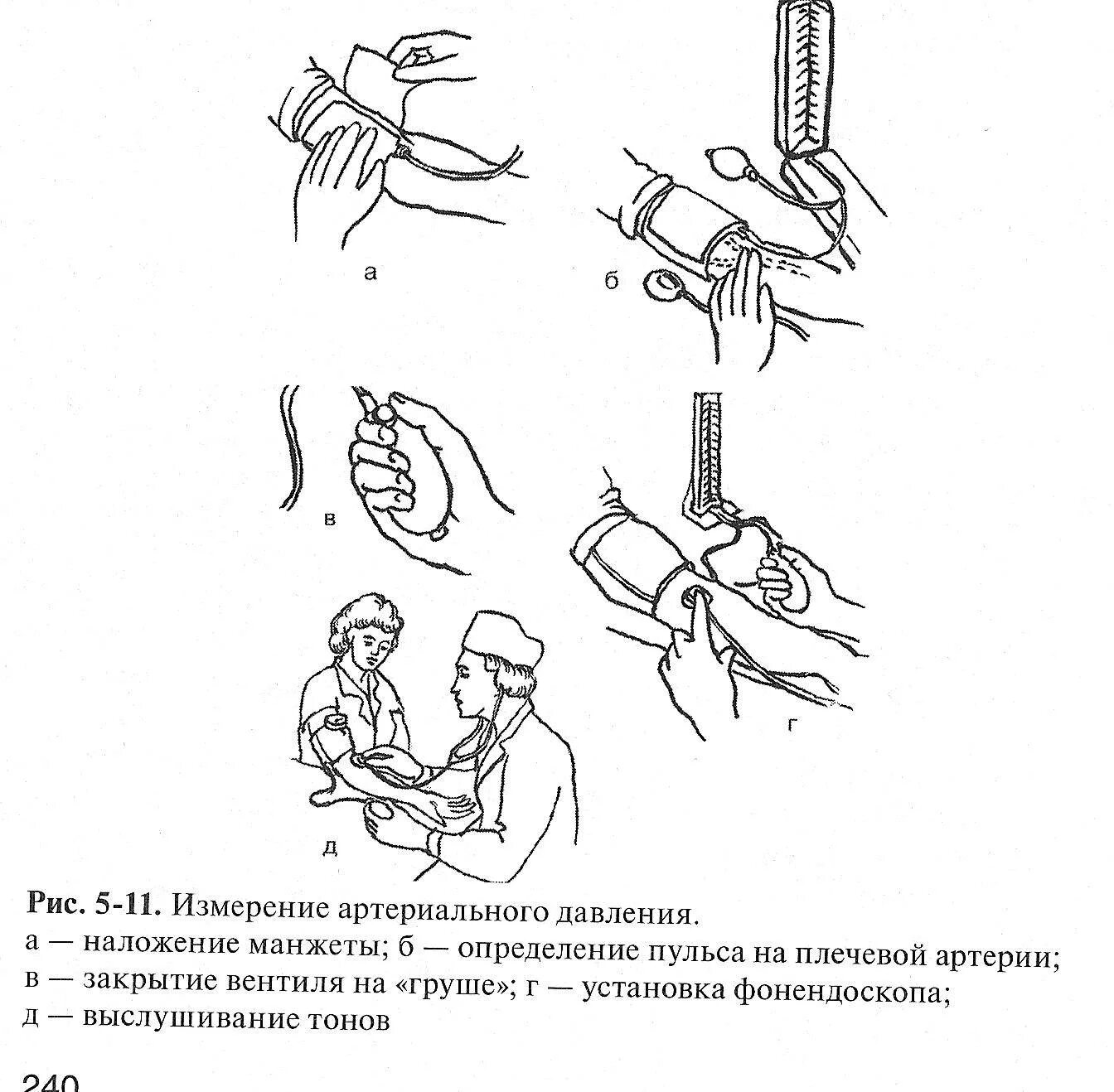 Манипуляция давлением. Артериальное давление алгоритм. Продемонстрировать технику измерения пульсового давления.. Измерение давления алгоритм манипуляции. Измерение артериального давления алгоритм.