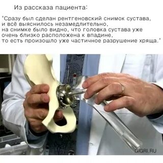Замена тазобедренного сустава в областной больнице