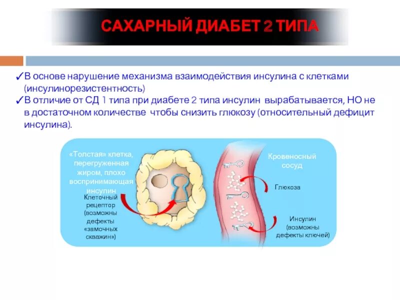 Сахарный диабет. Сахарный диабет 2 типа. Типы сахарного диабета 2 типа. Сахарный диабет 2 типа инсулинорезистентность.