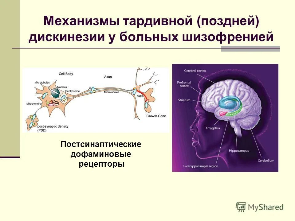 Тардивная дискинезия. Поздняя дискинезия. Поздняя дискинезия от нейролептиков. Постсинаптические дофаминергические рецепторы. Нейролепсия