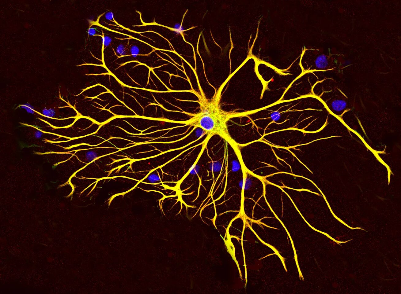 Вспомогательные нервные клетки. Нервные клетки и глиальные клетки. Астроциты глиальный. Нервная клетка и глия. Нервная ткань Нейроны и глиальные клетки.