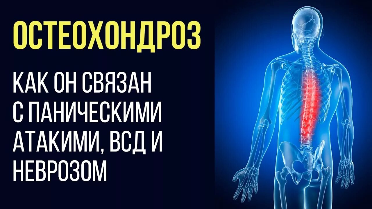 Панические атаки при остеохондрозе. Остеохондроз и панические атаки. ВСД И остеохондроз. Шейный остеохондроз и панические атаки. ВСД панические атаки и шейный остеохондроз.