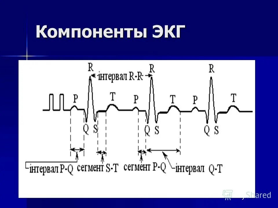 Экг. Компоненты нормальной ЭКГ. Формирование различных компонентов ЭКГ. Основные элементы ЭКГ. Электрокардиограмма с зубцами сегментами.