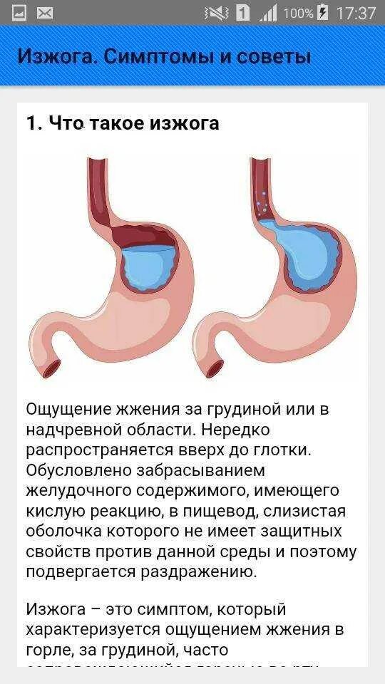 Изжога при беременности в третьем триместре. Изжога причины. Симптомы сильной изжоги.