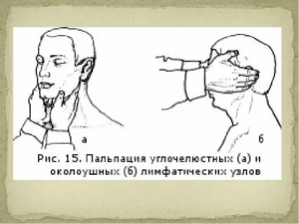 Пальпация лимфатических узлов