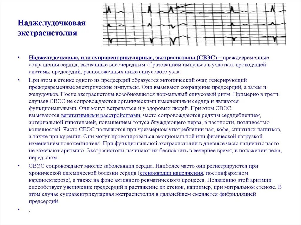 Одиночная наджелудочковая экстрасистолия на ЭКГ. Одиночная наджелудочковая экстрасистолия симптомы. Норма одиночные наджелудочковые экстрасистолы у ребенка. Наджелудочковая экстрасистолия 1:1. Одиночные экстрасистолы нормы