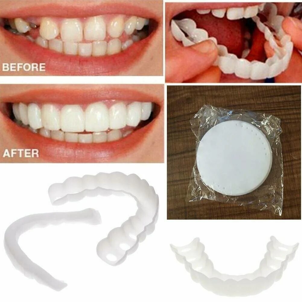 На зубы одевают виниры. Виниры комплект snap-on smile. надевают на зубы виниры.