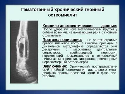 Острый остеомиелит формы