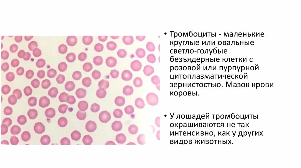 Крупные тромбоциты. Тромбоциты микроскопия. тромбоциты мазок крови. подсчет тромбоцитов в мазке. тромбоциты в мазке крови.